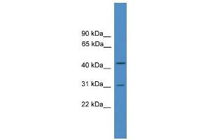 WB Suggested Anti-OTUD6A Antibody Titration: 0. (OTUD6A 抗体  (Middle Region))