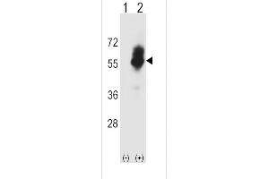 Western Blotting (WB) image for anti-Solute Carrier Family 7 (Cationic Amino Acid Transporter, Y+ System), Member 1 (SLC7A1) (AA 429-457), (C-Term) antibody (ABIN5534697)