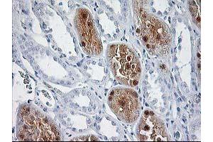 Immunohistochemical staining of paraffin-embedded Human Kidney tissue using anti-SOCS3 mouse monoclonal antibody. (SOCS3 抗体)