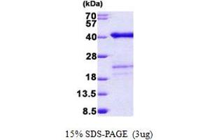 SDS-PAGE (SDS) image for Surfeit 2 (SURF2) (AA 1-256) protein (His tag) (ABIN5852983)