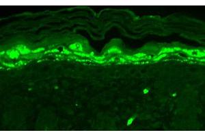 Immunohistochemistry of Mouse Anti-SHANK1 Antibody. (SHANK1 抗体  (Internal Region))