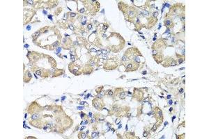 Immunohistochemistry of paraffin-embedded Human stomach using BCS1L Polyclonal Antibody at dilution of 1:100 (40x lens). (BCS1L 抗体)