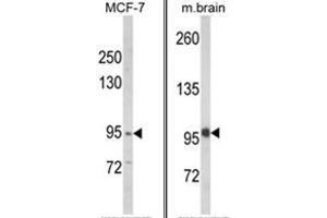 (LEFT) Western blot analysis of VPS53 Antibody (N-term) in MCF-7 cell line lysates (35ug/lane).