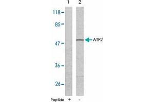 Western blot analysis of extract from LoVo cells using ATF2 polyclonal antibody  . (ATF2 抗体)