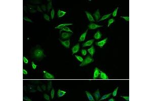 Immunofluorescence analysis of U2OS cells using NUTF2 Polyclonal Antibody (NUTF2 抗体)