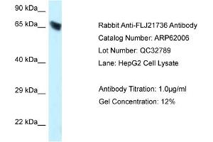 Western Blotting (WB) image for anti-Carboxylesterase 3 (CES3) (C-Term) antibody (ABIN2788984)