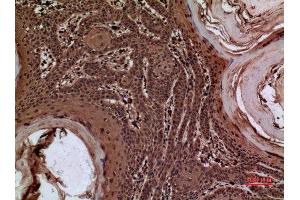 Immunohistochemistry (IHC) analysis of paraffin-embedded Human Skin, antibody was diluted at 1:100.
