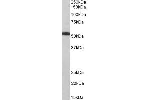 Western Blotting (WB) image for anti-ATP Synthase, H+ Transporting, Mitochondrial F1 Complex, alpha Subunit 1, Cardiac Muscle (ATP5A1) antibody (ABIN5910982) (ATP5A1 抗体)