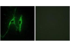 Immunofluorescence analysis of NIH-3T3 cells, using CYB5 Antibody. (Cytochrome b5 (CYTB5) (AA 61-110) 抗体)