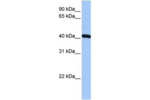 Western Blotting (WB) image for anti-FtsJ RNA Methyltransferase Homolog 1 (FTSJ1) antibody (ABIN2463265) (FTSJ1 抗体)