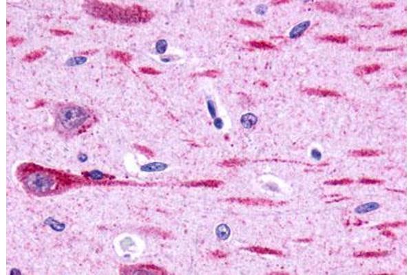 GPR162 抗体  (Extracellular Domain)