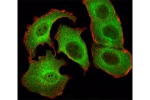Immunohistochemical analysis of paraffin-embedded human skeletal muscle section using SMAD1 antibody (SMAD1 抗体  (AA 163-196))