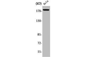 Western Blot analysis of HeLa cells using Phospho-Erbin (Y1104) Polyclonal Antibody (ERBB2IP 抗体  (pTyr1104))