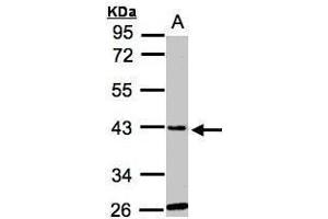 WB Image Sample(30 ug whole cell lysate) A:Hep G2 , 10% SDS PAGE antibody diluted at 1:1000 (GLYATL1 抗体)
