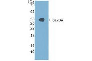 Western blot analysis of recombinant Human PAK1. (PAK1 抗体  (AA 252-501))