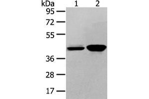 Western Blotting (WB) image for anti-Vasohibin 2 (VASH2) antibody (ABIN5958782) (Vasohibin 2 抗体)