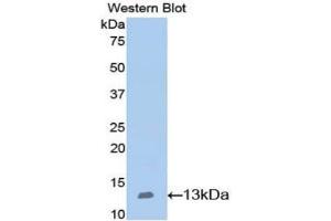 Western blot analysis of the recombinant protein. (Nephrin 抗体  (AA 39-144))