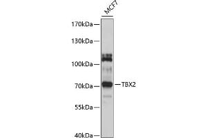 Western blot analysis of extracts of MCF-7 cells, using TBX2 antibody (ABIN6130916, ABIN6148906, ABIN6148907 and ABIN6214429) at 1:1000 dilution. (TBX2 抗体  (AA 300-470))