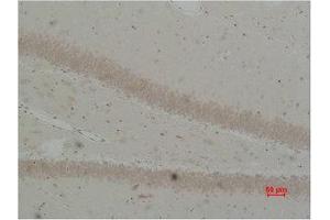 Immunohistochemistry (IHC) analysis of paraffin-embedded Rat Brain Tissue using BEST2 Polyclonal Antibody. (Bestrophin 2 抗体)