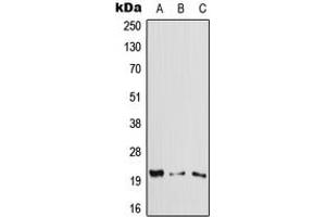 Western blot analysis of Cytoglobin expression in HeLa (A), Raw264. (CYGB 抗体  (Center))