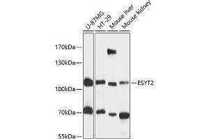 Western blot analysis of extracts of various cell lines, using ESYT2 antibody (ABIN6133009, ABIN6140463, ABIN6140464 and ABIN6216602) at 1:3000 dilution. (FAM62B 抗体  (AA 630-760))