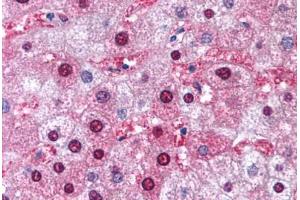 Human Liver (formalin-fixed, paraffin-embedded) stained with GSTM1 antibody ABIN214769 at 5 ug/ml followed by biotinylated goat anti-rabbit IgG secondary antibody ABIN481713, alkaline phosphatase-streptavidin and chromogen. (GSTM1 抗体  (AA 31-80))