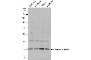 WB Image Aspartoacylase antibody detects Aspartoacylase protein by western blot analysis. (ASPA 抗体)