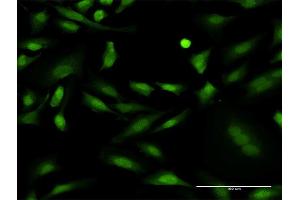 Immunofluorescence of monoclonal antibody to PRKCD on HeLa cell. (PKC delta 抗体  (AA 577-676))