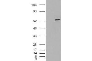 HEK293 overexpressing IGF2BP2 (ABIN5436057) and probed with ABIN238651 (mock transfection in first lane). (IGF2BP2 抗体  (C-Term))