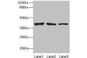 Western blot All lanes: ATP6AP2 antibody at 10 μg/mL Lane 1: Mouse eye tissue Lane 2: COLO205 whole cell lysate Lane 3: Hela whole cell lysate Secondary Goat polyclonal to rabbit IgG at 1/10000 dilution Predicted band size: 40, 36 kDa Observed band size: 40 kDa (ATP6AP2 抗体  (AA 17-350))