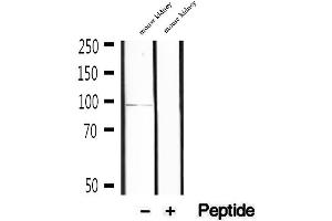 Western blot analysis of extracts of mouse kidney tissue, using KIFC3 antibody. (KIFC3 抗体  (C-Term))