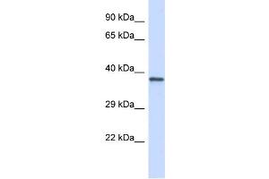 Host: Rabbit Target Name: GP1BA Sample Type: Jurkat Whole Cell lysates Antibody Dilution: 1. (CD42b 抗体  (Middle Region))