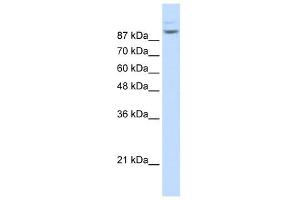 Matrin 3 antibody used at 1. (MATR3 抗体  (N-Term))