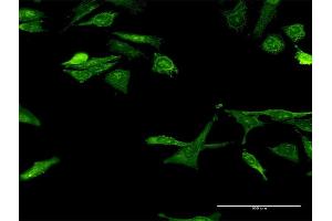 Immunofluorescence (IF) image for anti-Gem (Nuclear Organelle) Associated Protein 7 (GEMIN7) (AA 43-131) antibody (ABIN529039)