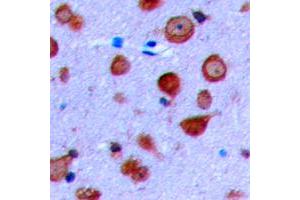 Immunohistochemical analysis of Kir6. (KCNJ11 抗体  (Center))