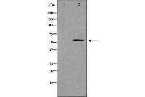 Western blot analysis of extracts from LOVO cells using Cytochrome P450 39A1 antibody. (CYP39A1 抗体  (C-Term))