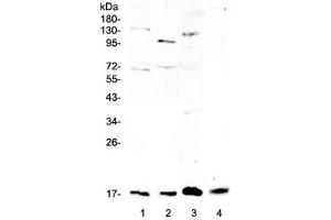 Western blot testing of 1) rat brain, 2) rat lung, 3) rat RH35 and 4) mouse lung lysate with Il1f10 antibody at 0. (IL1F10 抗体)