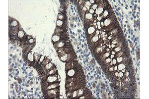 Image no. 8 for anti-Src-like-adaptor 2 (SLA2) antibody (ABIN1500949)