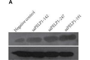 PELP1 activation promoted proliferation, colony formation, migration of GES-1 in vitro. (PELP1 抗体)