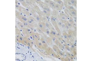 Immunohistochemistry of paraffin-embedded human liver using PTTG1 antibody (ABIN5974823) at dilution of 1/100 (40x lens). (PTTG1 抗体)