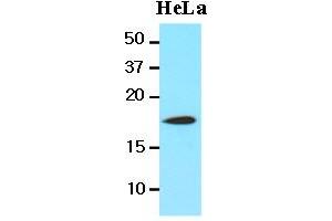 Western Blotting (WB) image for anti-Cofilin 1 (CFL1) (AA 1-166), (N-Term) antibody (ABIN336102) (Cofilin 抗体  (N-Term))