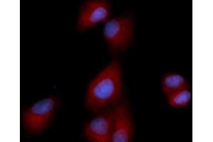 Immunofluorescence (IF) image for anti-Dipeptidyl-Peptidase 4 (DPP4) (AA 39-766) antibody (PE) (ABIN5566986)