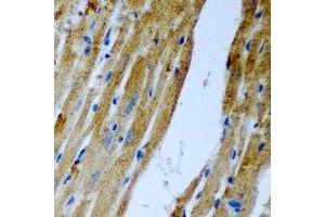 Immunohistochemical analysis of Malcavernin staining in rat heart formalin fixed paraffin embedded tissue section. (CCM2 抗体)