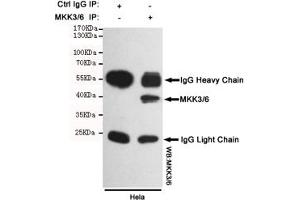 Immunoprecipitation analysis of Hela cell lysates using MKK3/6 mouse mAb. (MKK3/6 抗体)