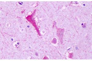 Anti-GPR137B antibody IHC staining of brain, neurons. (GPR137B 抗体  (C-Term))