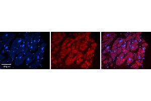 Rabbit Anti-ADAR Antibody   Formalin Fixed Paraffin Embedded Tissue: Human heart Tissue Observed Staining: Cytoplasmic Primary Antibody Concentration: N/A Other Working Concentrations: 1:600 Secondary Antibody: Donkey anti-Rabbit-Cy3 Secondary Antibody Concentration: 1:200 Magnification: 20X Exposure Time: 0.