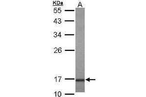 WB Image Sample (30 ug of whole cell lysate) A: Hela 10% SDS PAGE antibody diluted at 1:1000 (UBE2A 抗体)