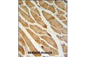 ISLR Antibody (C-term) (ABIN651071 and ABIN2840058) IHC analysis in formalin fixed and paraffin embedded skeletal muscle followed by peroxidase conjugation of the secondary antibody and DAB staining.