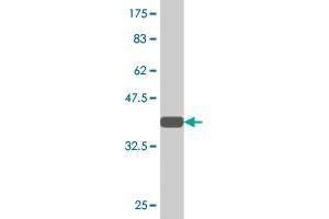 Western Blot detection against Immunogen (32. (PCGF2 抗体  (AA 236-294))