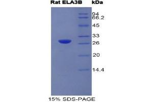 SDS-PAGE (SDS) image for Elastase 3B, Pancreatic (ELA3B) (AA 28-269) protein (His tag) (ABIN1981157) (Elastase 3B Protein (AA 28-269) (His tag))